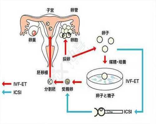 传递!青海地下供卵机构"放冷箭"
