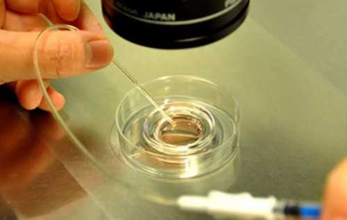 汕头哪里做试管婴儿移植胚胎的技术比较好?